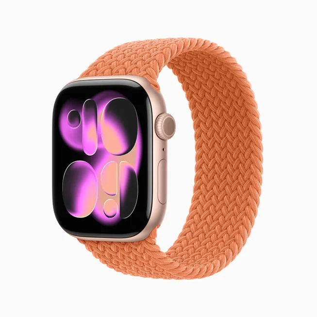 Foto real de Apple Watch Series 11 GPS 42 mm